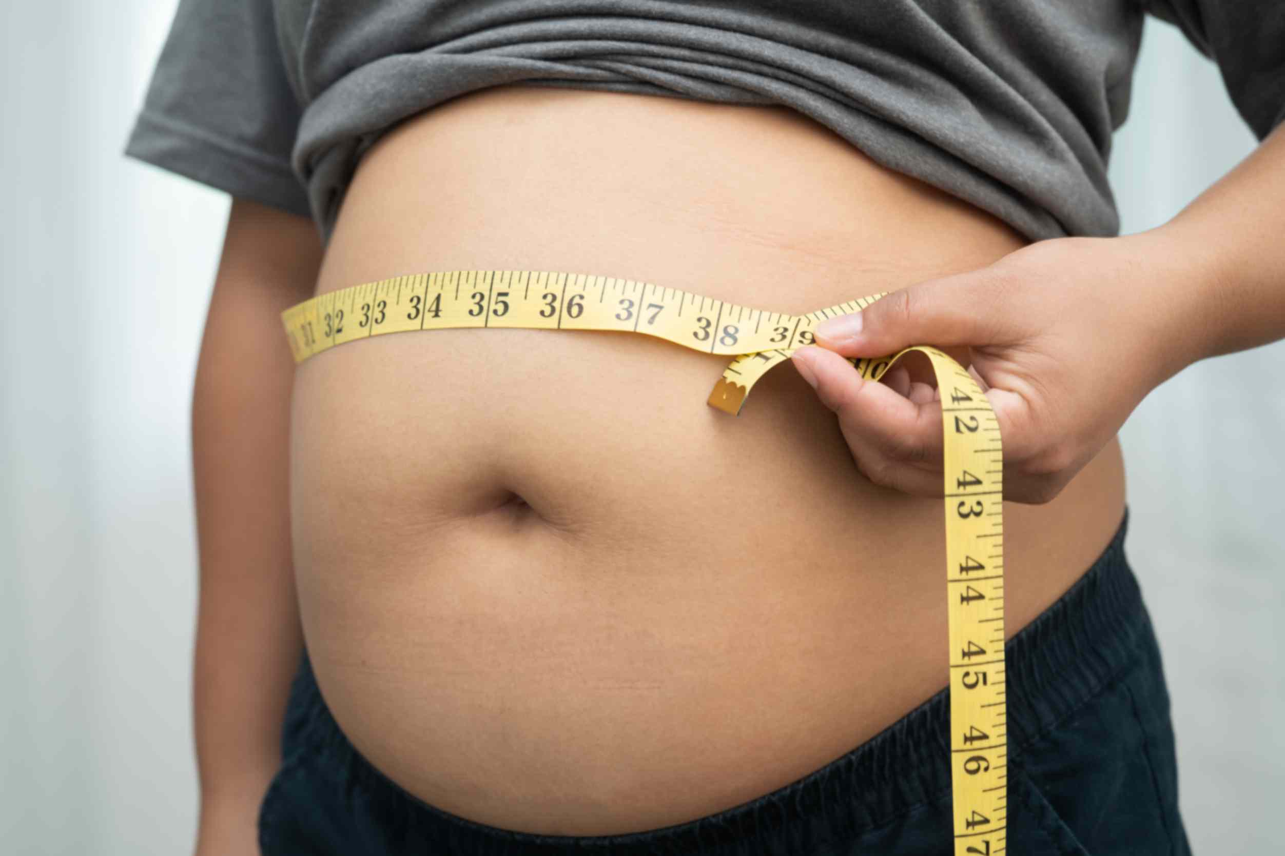 Obesity Treatment